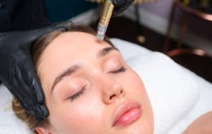 mezoterapia-frakcyjna-1-3 NanoFrax dermapen